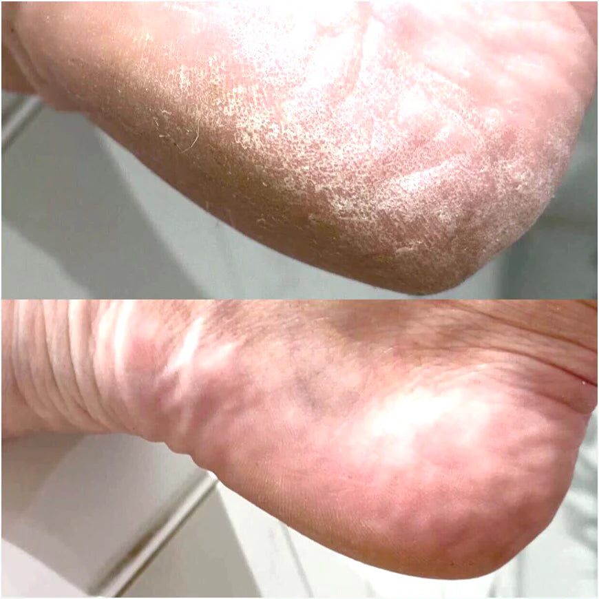 LOVASKIN INSTANT FOOT PEEL Spray bottle 75 ml